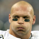 Illustration for article titled Brian Urlacher Out Four To Six Weeks With Excuses